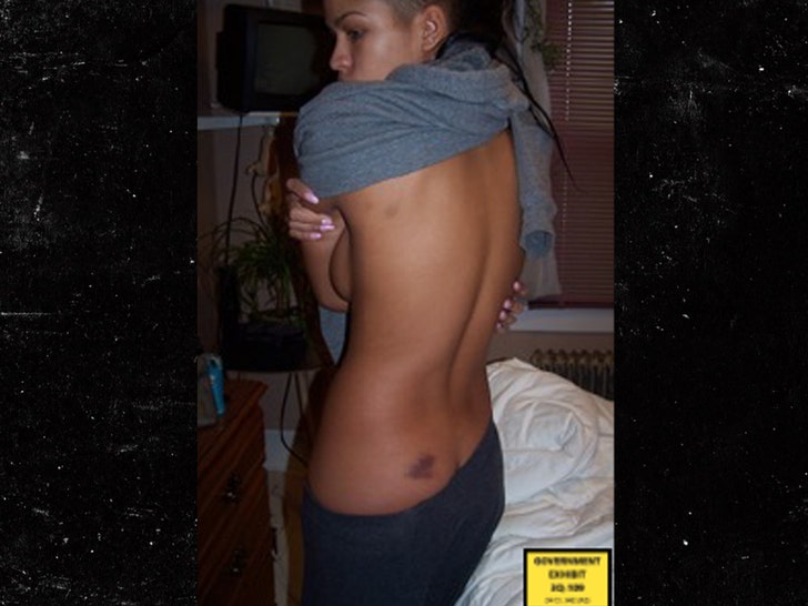 cassie alleged body injuries