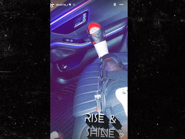 rashee rice leg insta post