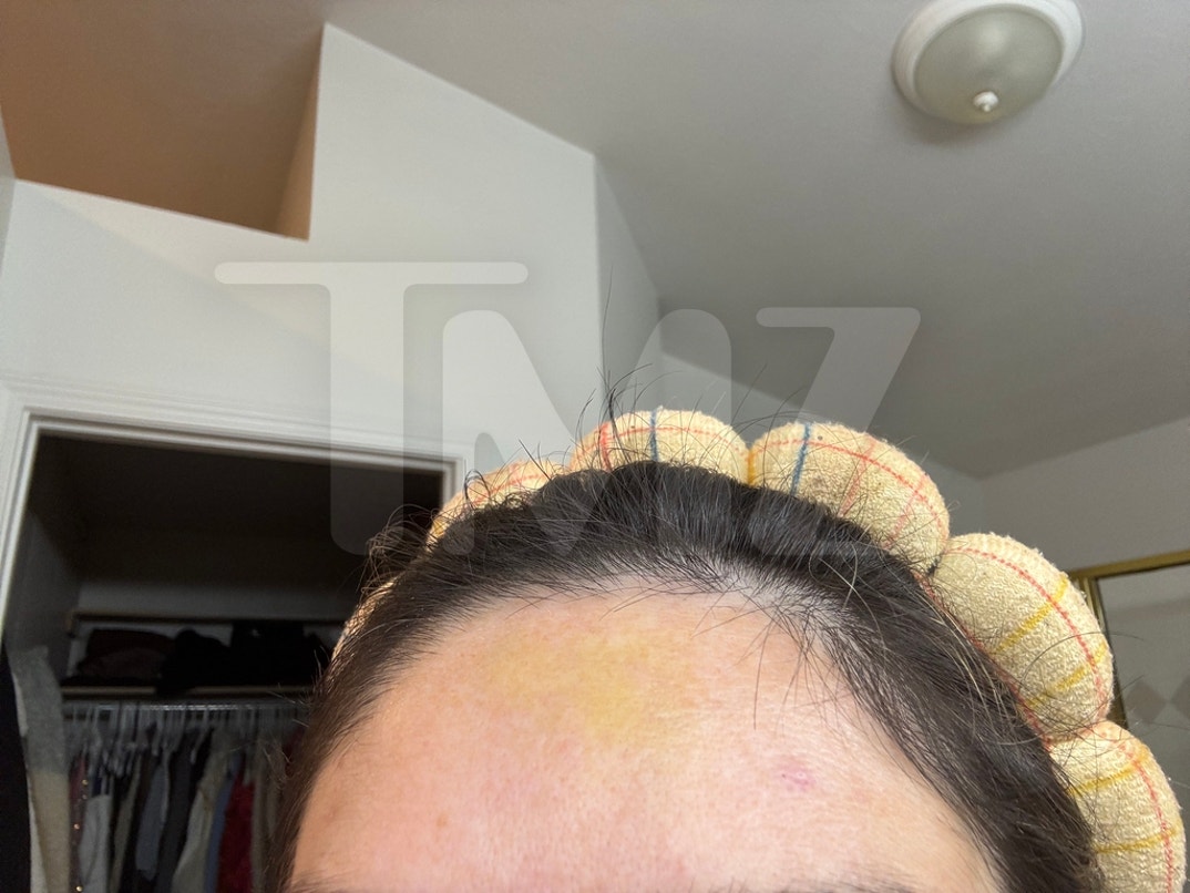 Taylor Frankie Paul Alleged Injuries  1