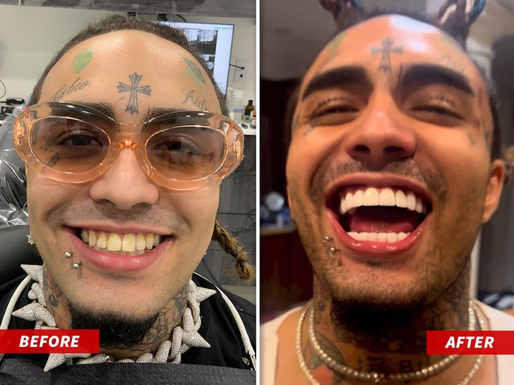 lilpump has permanently removed all of his face tattoos🤷🏼‍♂️… what do you  think? 😳👇🏼 | Instagram