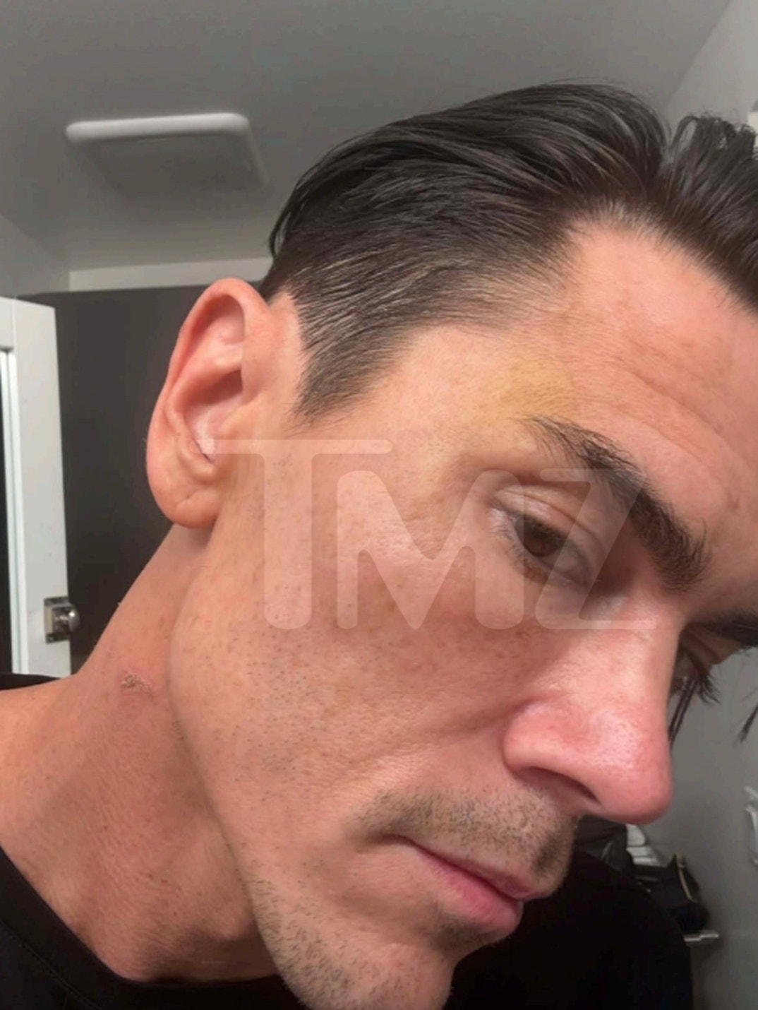 Tom Sandoval Injuries 2