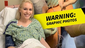 Lindsey Vonn Posts Disgusting Picture Of Knee During LCL Surgery