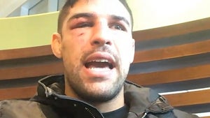 UFC's Vicente Luque's Face Is Wedding Planner's Nightmare After Barberena Fight