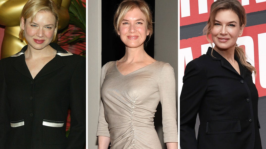 1023-Renee-Zellweger-Through-The-Years-PRIMARY