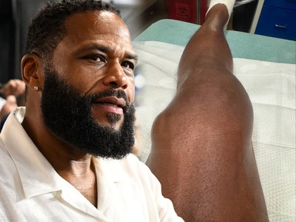 anthony anderson injury getty insta 1