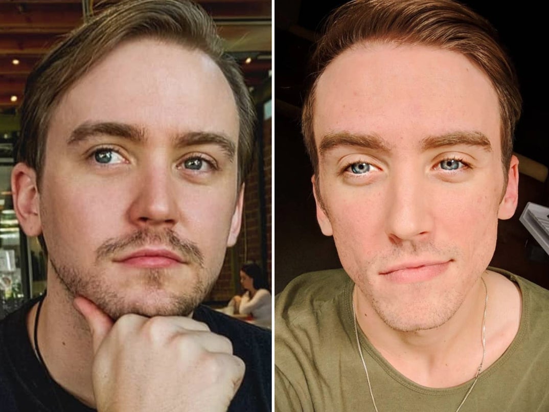 Blake (left) and Dylan (right) Tuomy-Wilhoit -- who are now 30 years old  -- shared some grown-up selfies looking like bros.