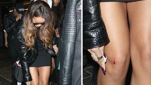 Rihanna Bloodied After Alleged London Club Run-in