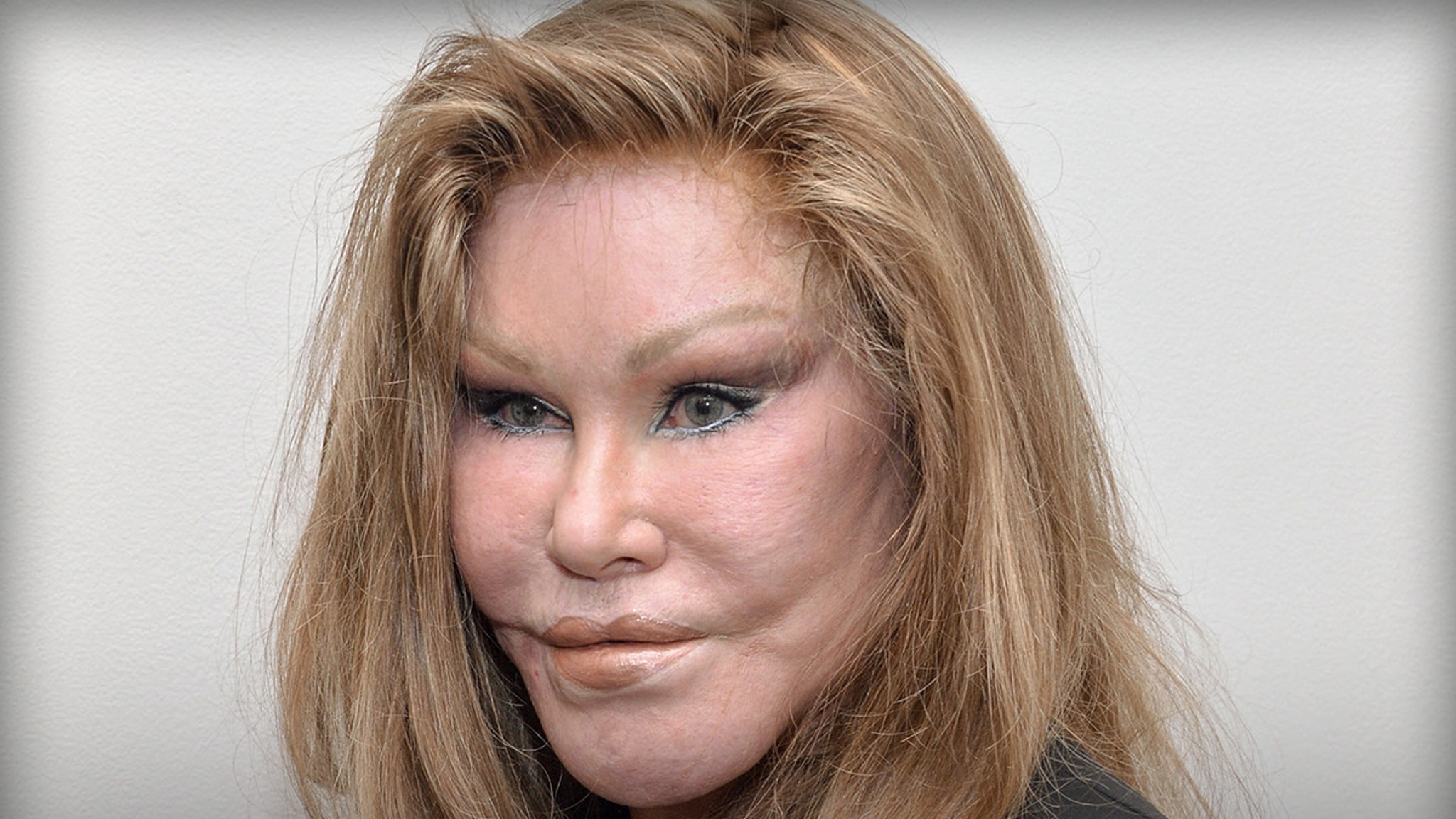 ‘Catwoman’ Jocelyn Wildenstein Dead At 84