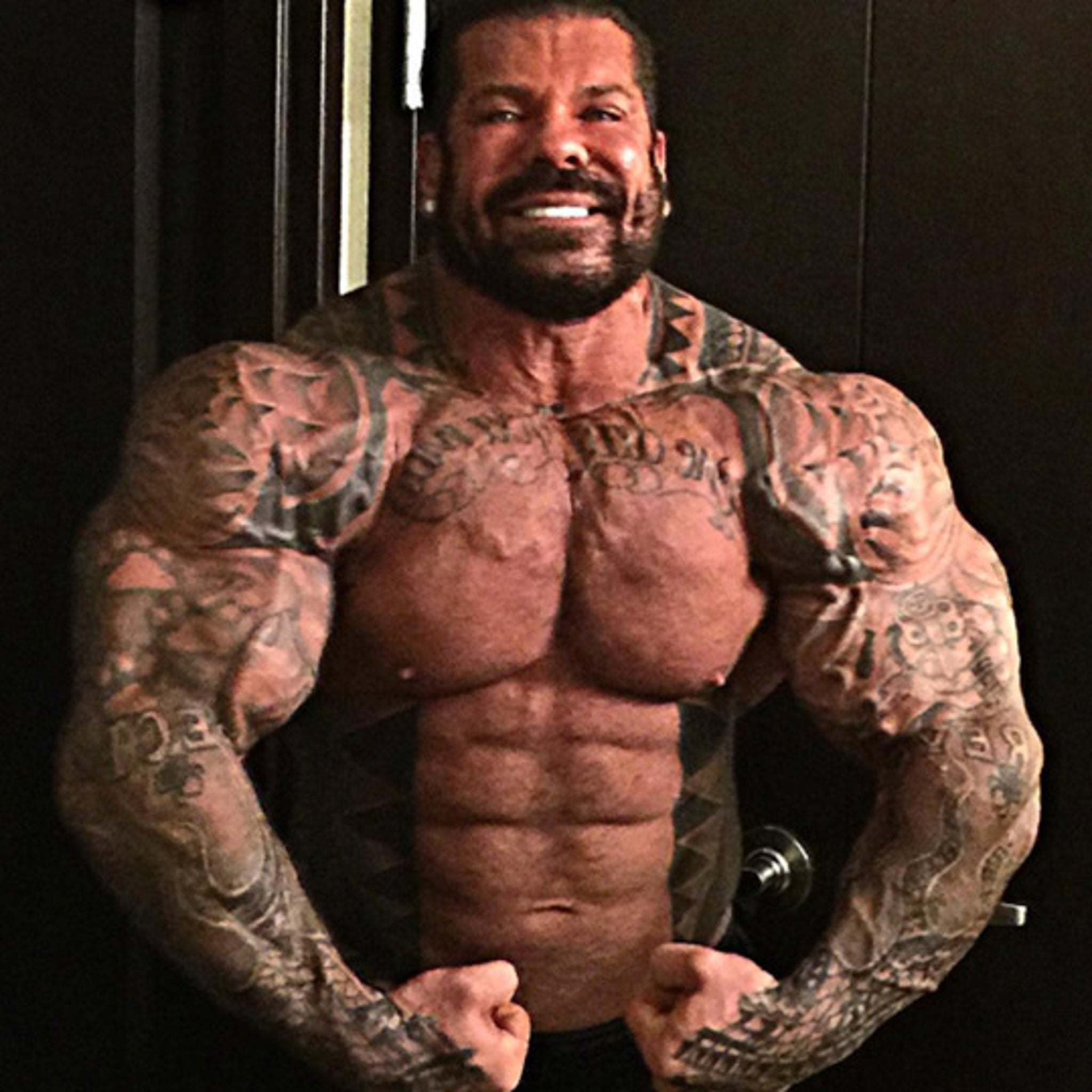 Bodybuilder Rich Piana Had 20 Bottles Of Steroids During Medical Images, Photos, Reviews
