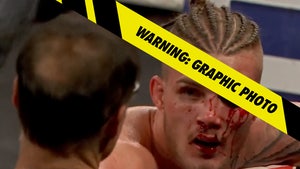 Bare Knuckle Fighter Jordan Nash Suffers Gruesome Eye Injury During Fight