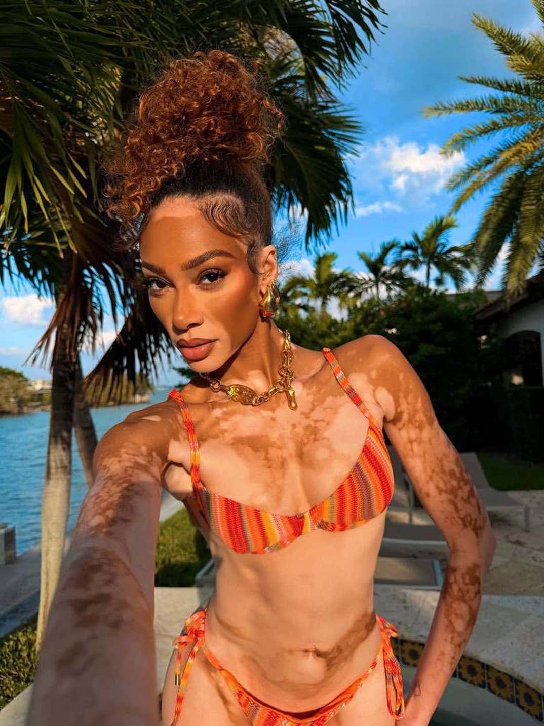Winnie Harlow