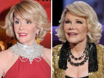 Joan Rivers