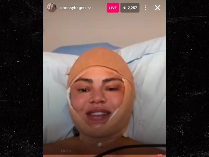 Chrissy-Intigen-Surgery-Iig-1