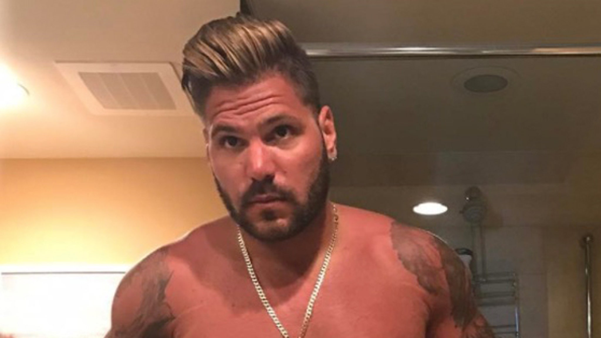 Celebrity Sunburns -- Guess Who!