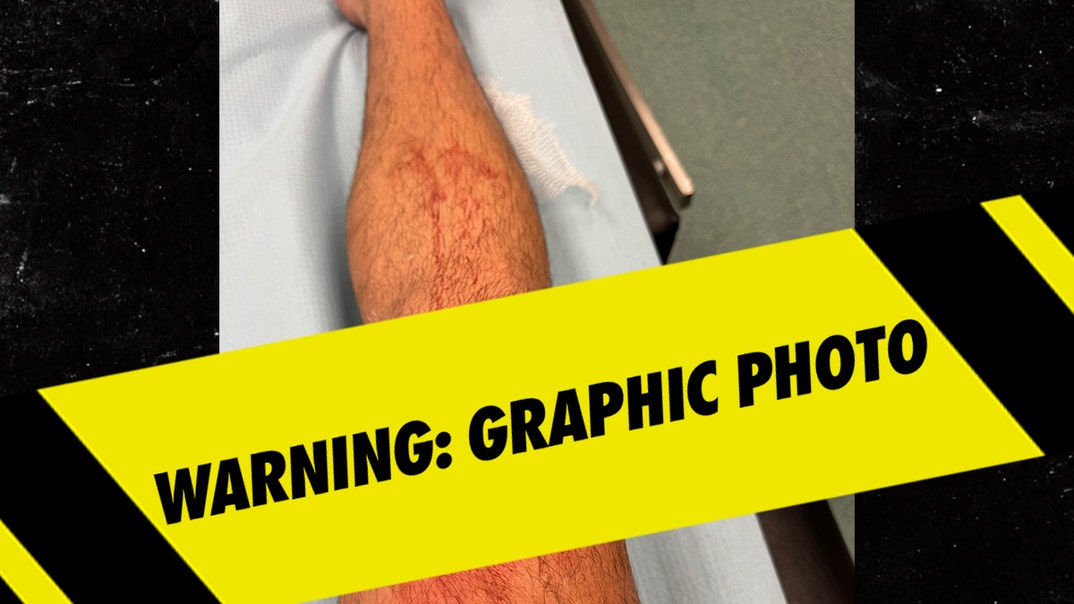 big time rush injury launch