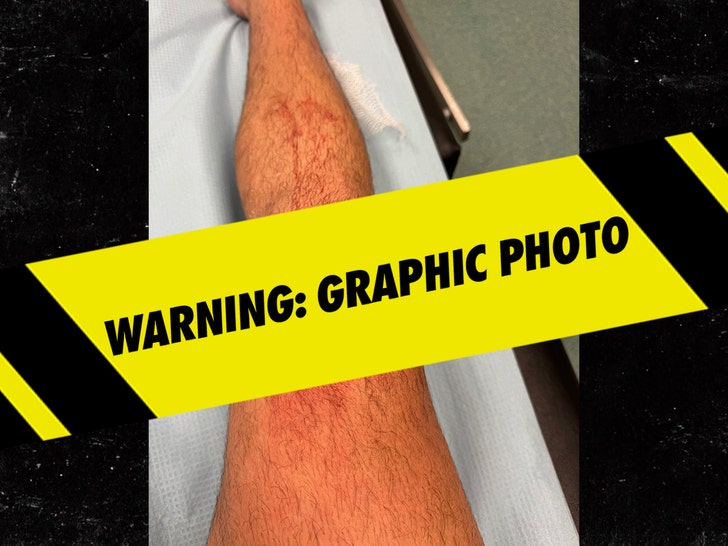 Logan Henderson's Gnarly Knee Injury