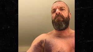 Triple H Reveals Gnarly Injury Pic After Tearing Chest Muscle