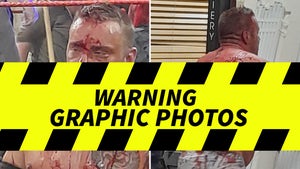 Pro Wrestling 'Death Match' Turns Into Bloody Event, Police Investigating