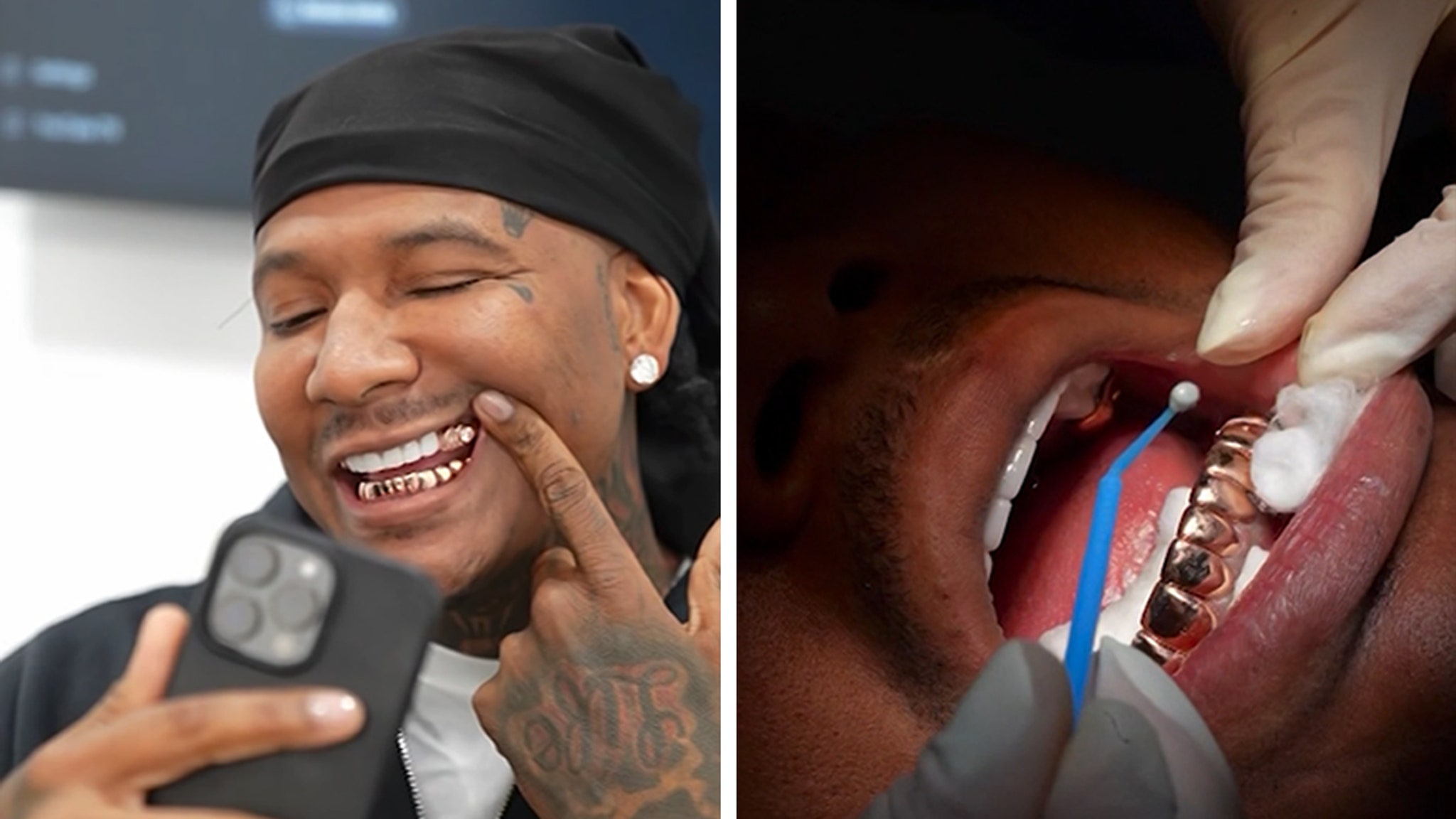 Moneybagg Yo Gets 0K Gold Grill in Miami