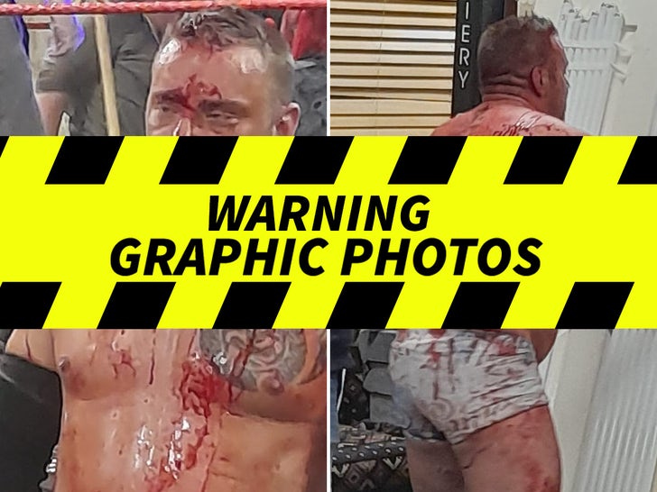 Graphic Injuries During CCW Wrestling Match