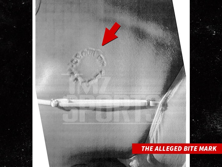 puka nacu Alleged Bite Injury tmzsports 1