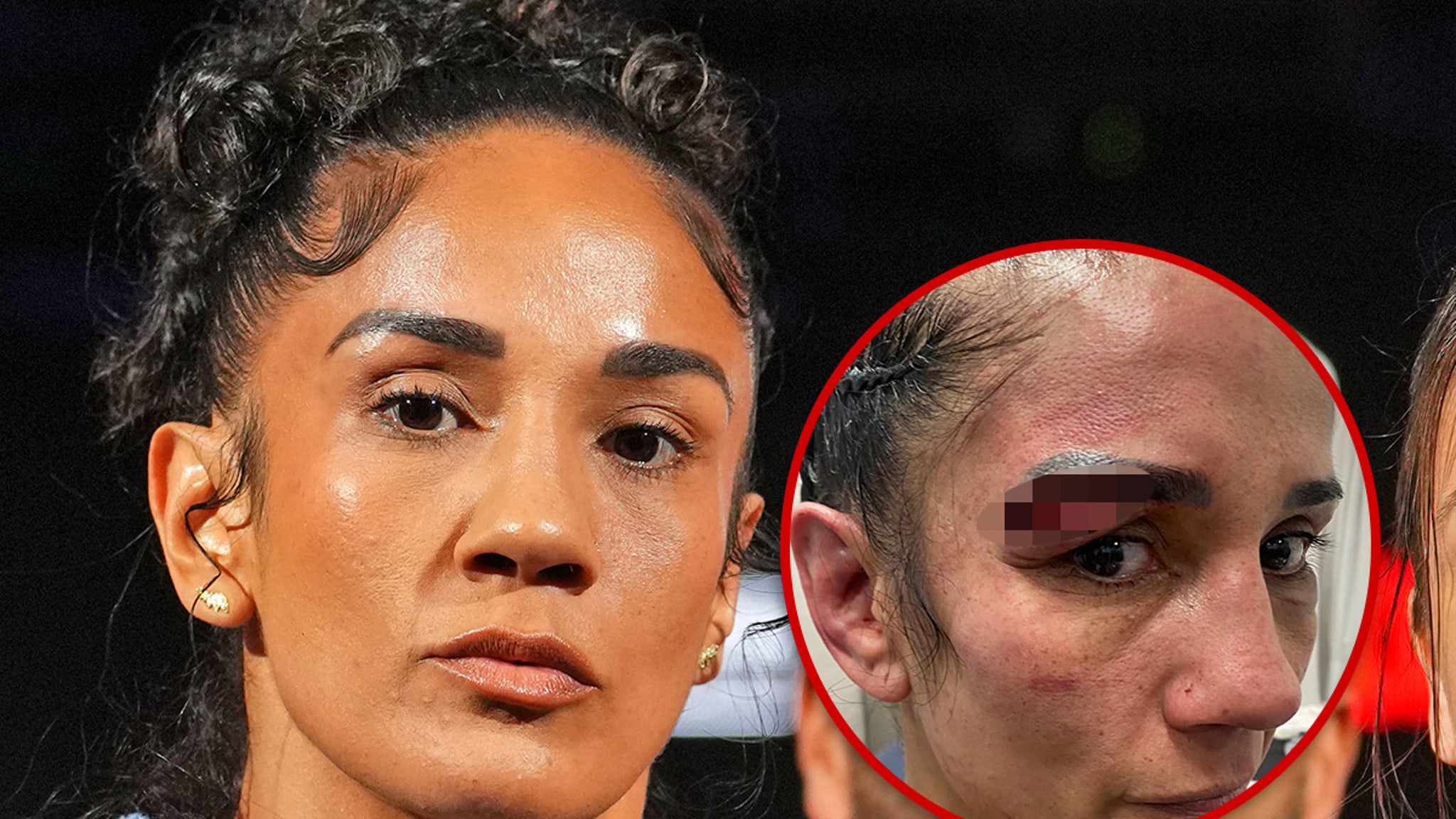 Amanda Serrano Shares Gruesome Injury Pic After Loss to Katie Taylor