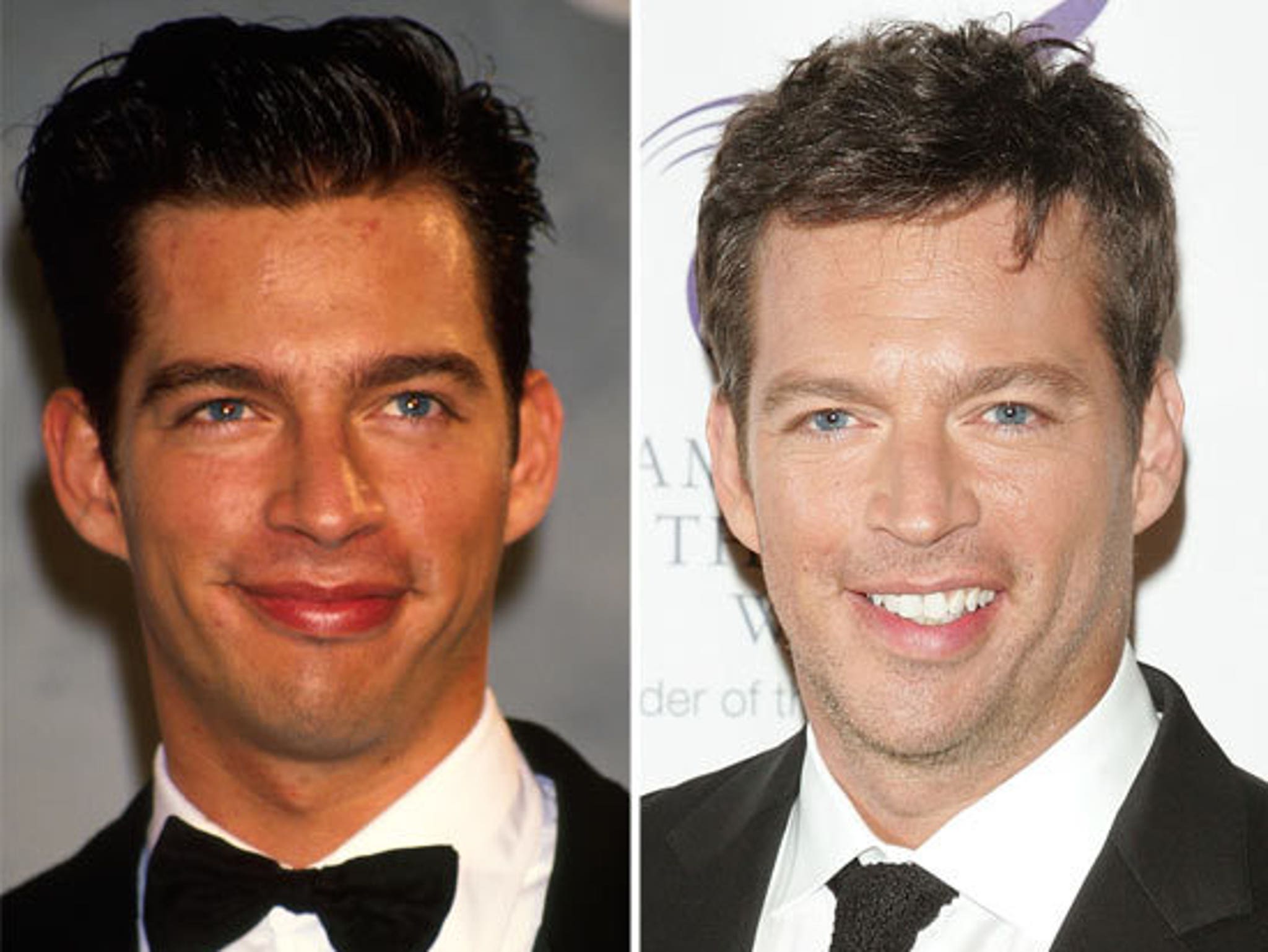 Harry Connick Jr. Good Genes or Good Docs