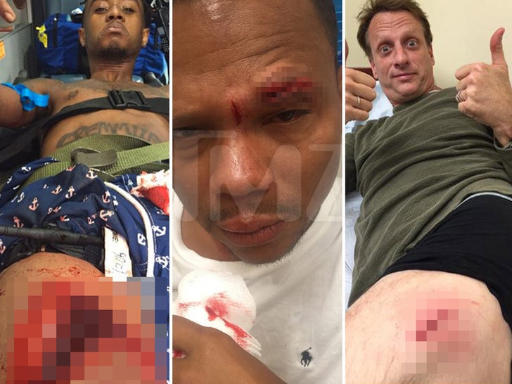 Gruesome Celebrity Injuries