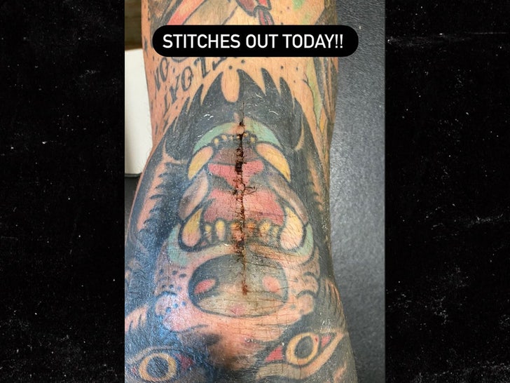 1110-taylor-lewan-stitches-insta-02