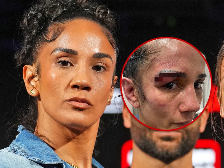 Amanda Serrano Shares Gruesome Injury Pic After Loss to Katie Taylor