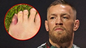 Conor McGregor Reveals Injury That Forced Him Out Of UFC 303 Main Event