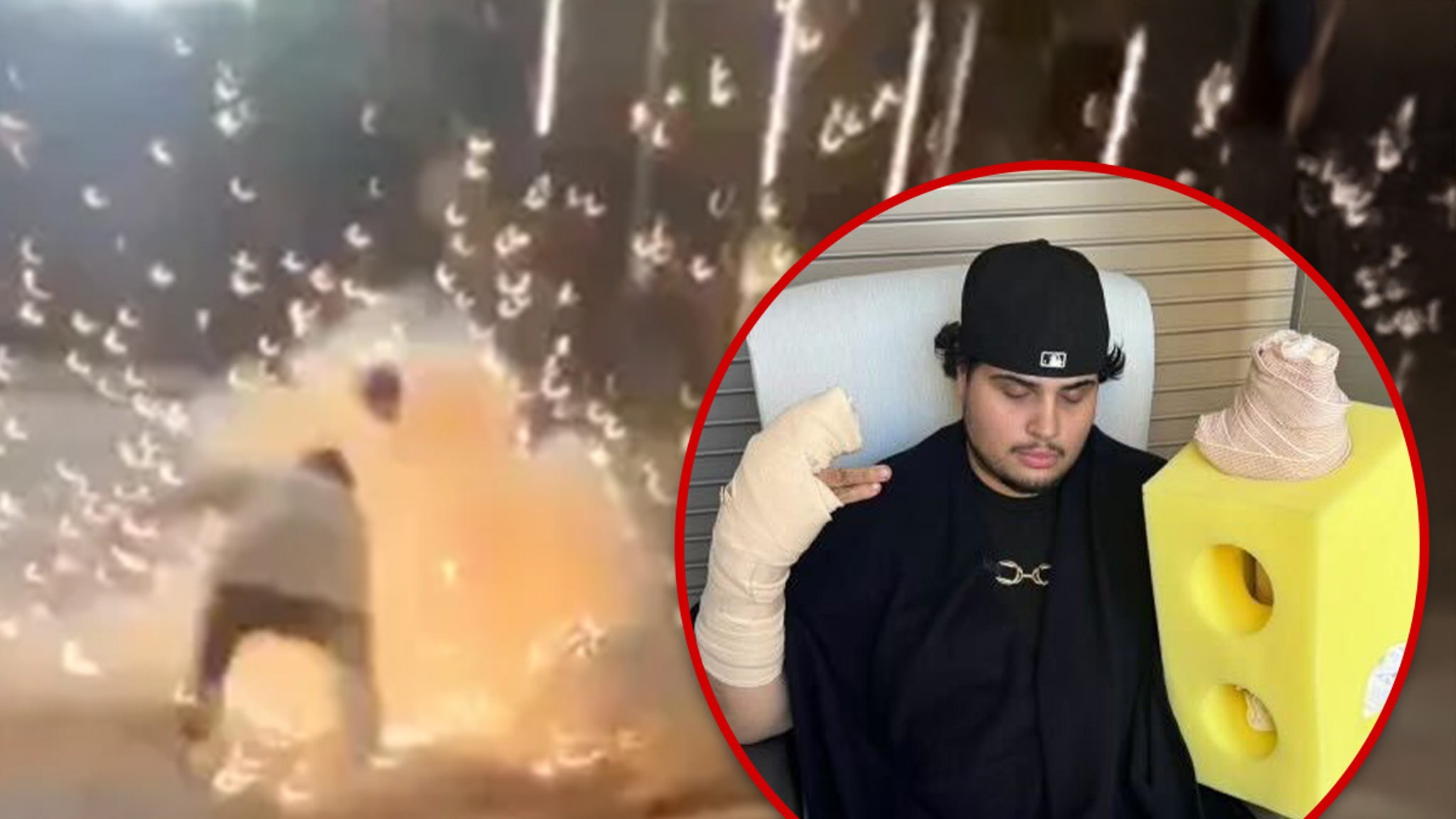 Dodgers Fan Reveals Gruesome Injury Photos After World Series Firework Mishap