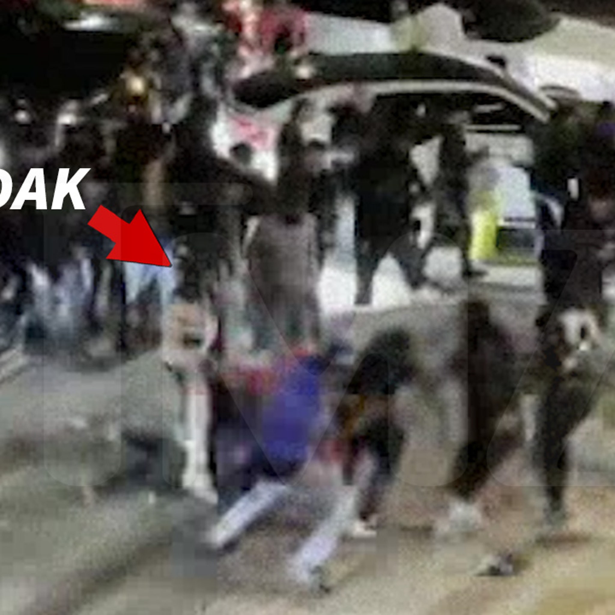 Kodak Black Shows Off Leg Injury After Being Shot During Super