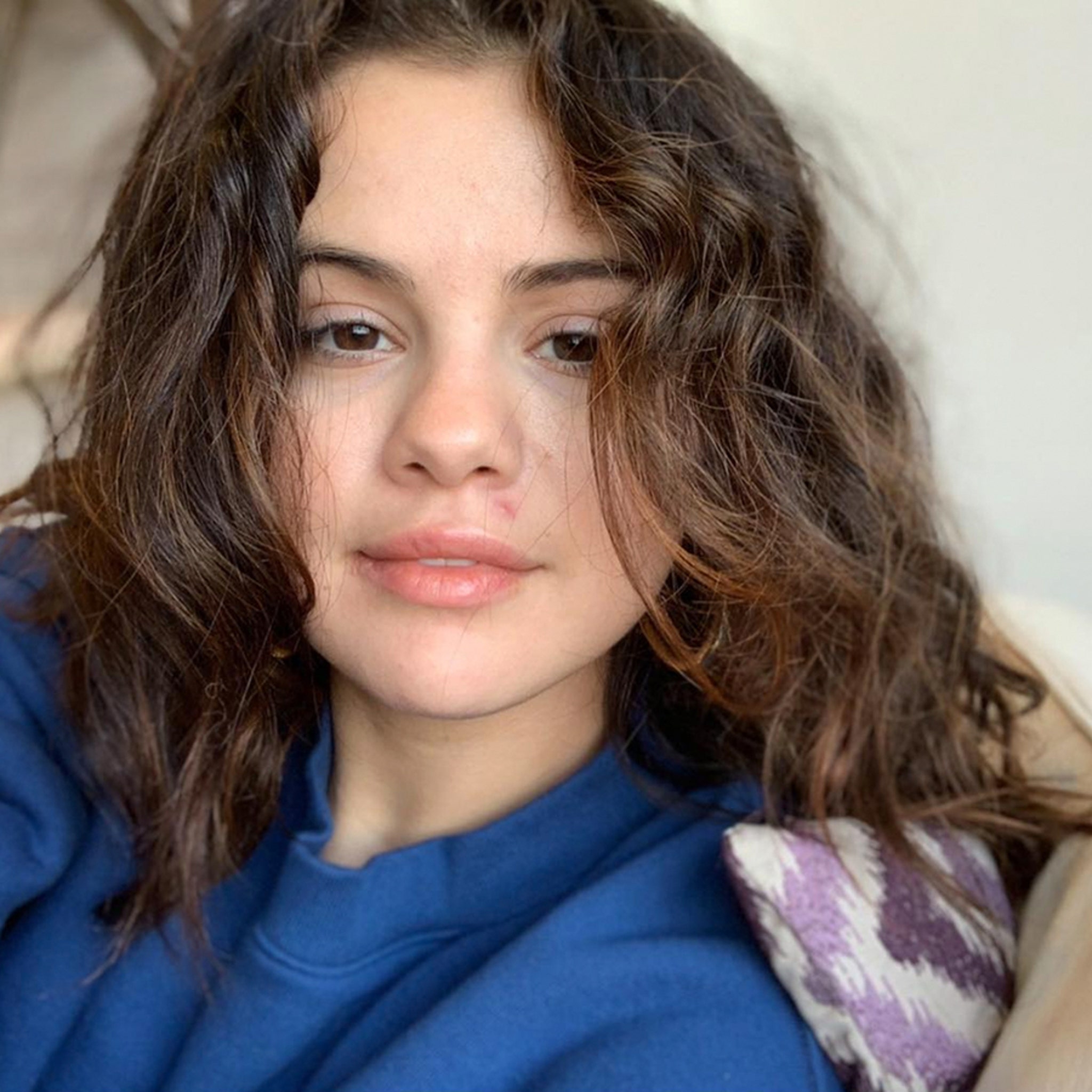 Selena Gomez Shares Unfiltered Photos, Gets Online Support picture