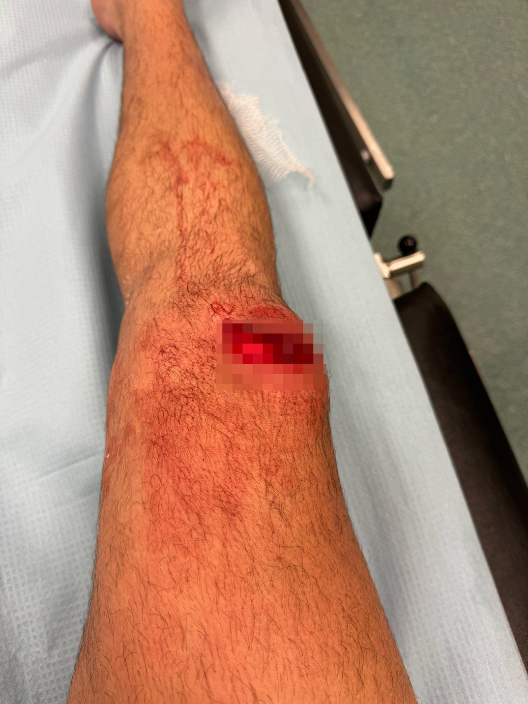 Logan Henderson Knee Blur