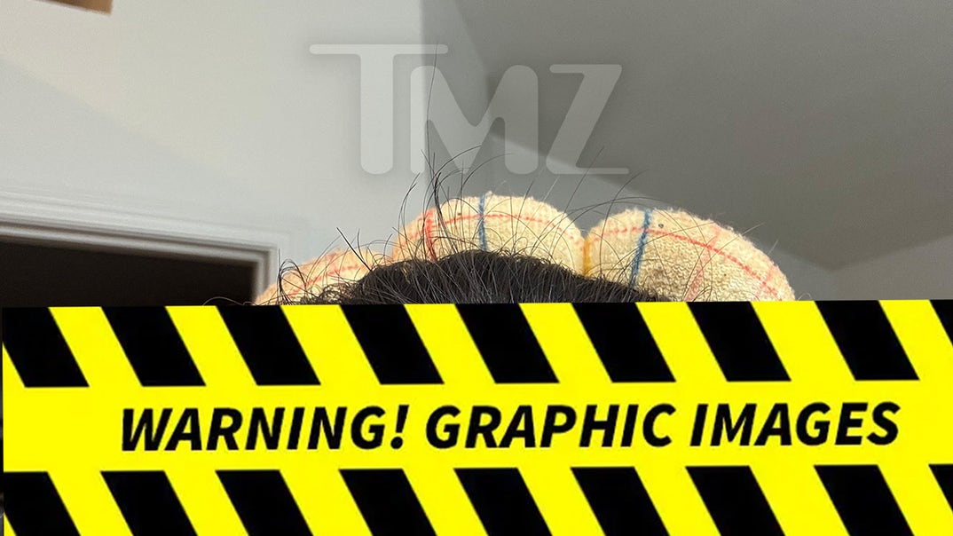 0416-Taylor-Frankie-Paul-Alleged-Injuries-PRIMARY