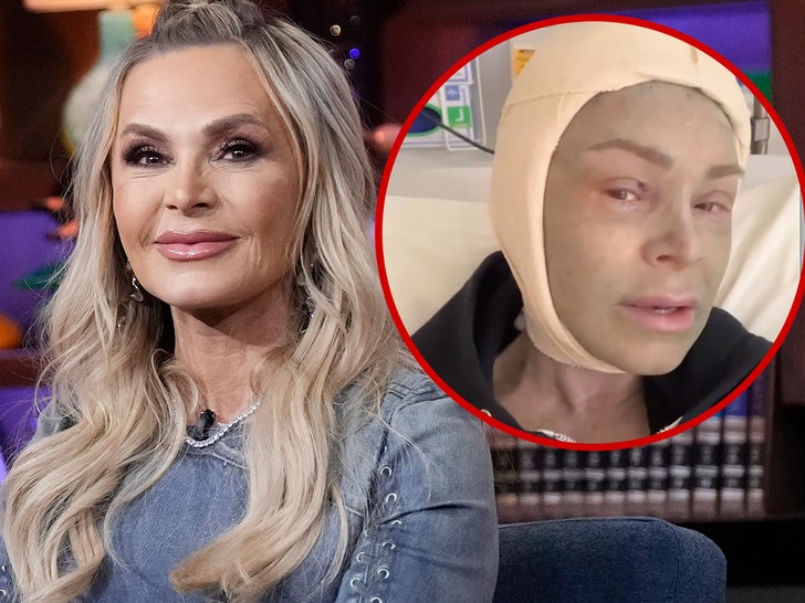 Tamra Judge Documents Brow Lift