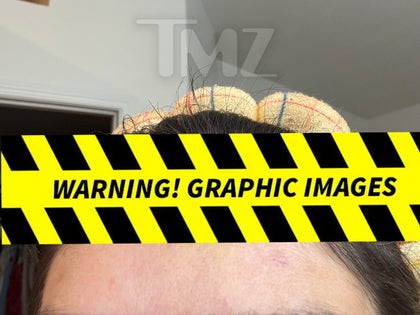 0416-Taylor-Frankie-Paul-Alleged-Injuries-PRIMARY