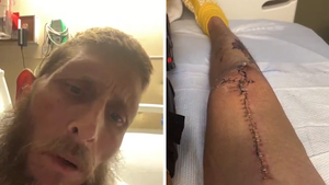 'Moonshiners' Josh Owens Talks Motorcycle Crash, Broken Neck, Back, Legs and Arm