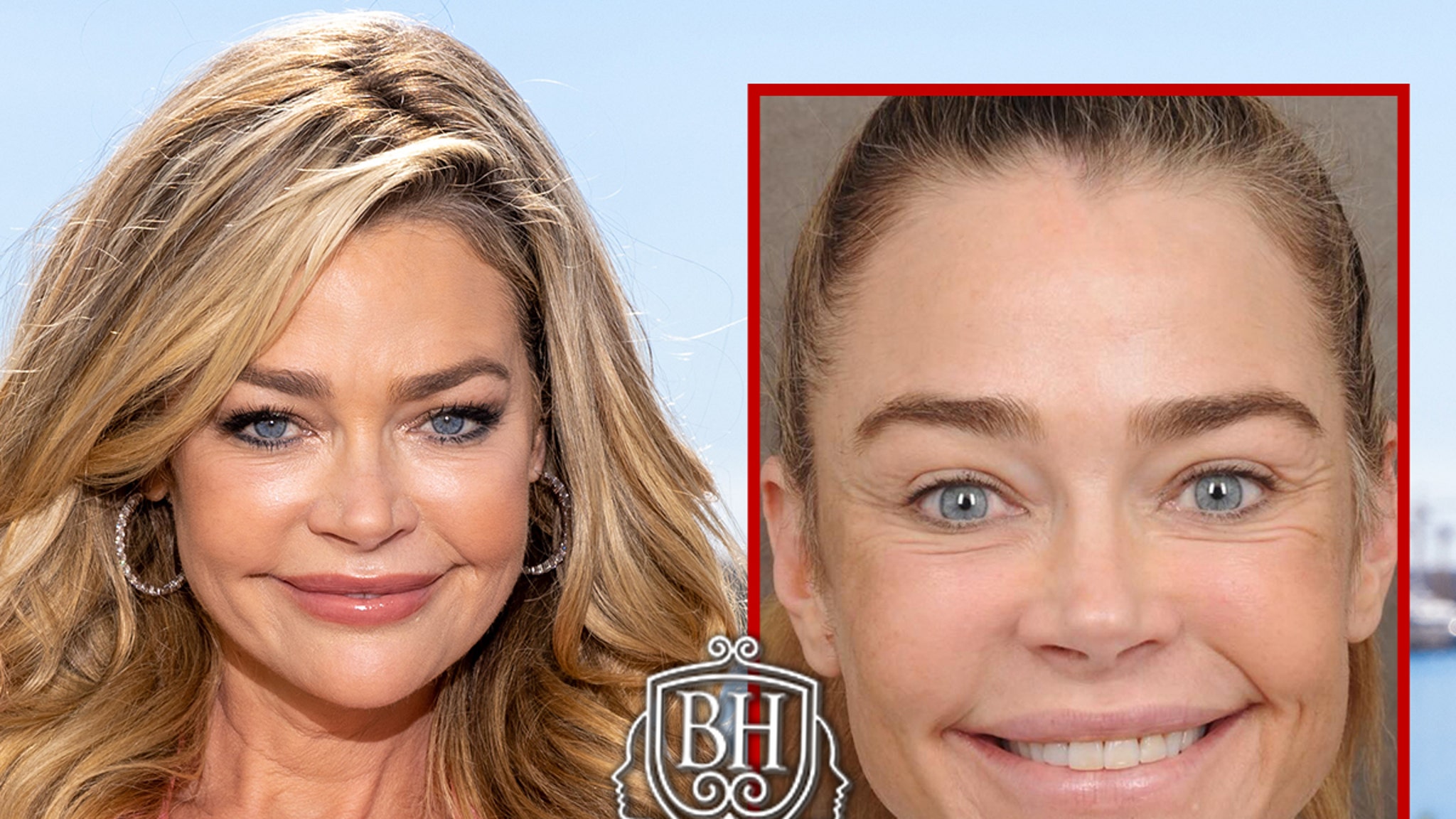Voor en na foto’s van Denise Richards die haar chirurgenbedrijf opschaalt