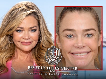 denise-richards-getty-Instagram---@drbentalei-1