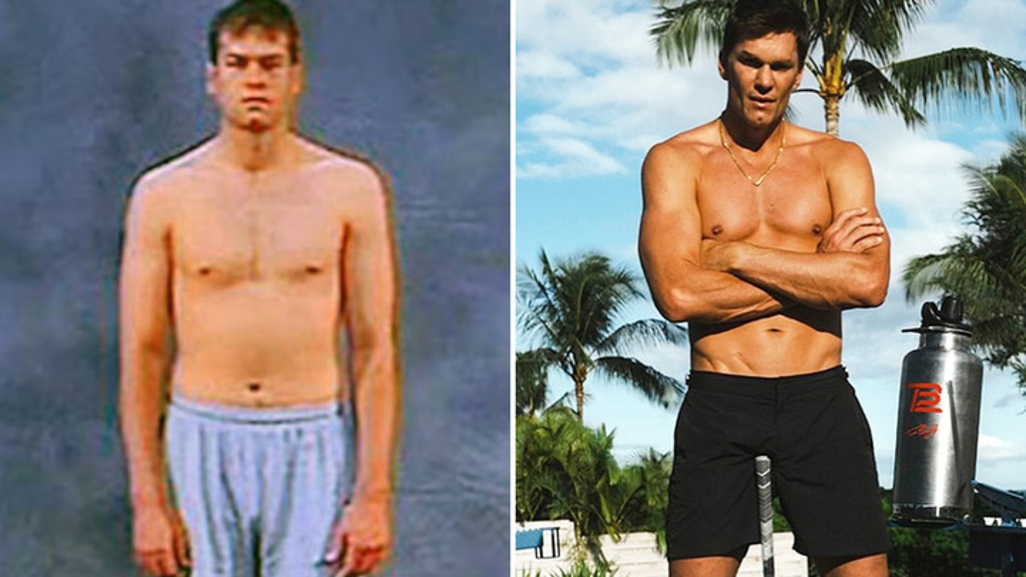 Tom Brady Good Genes or Good Docs?!