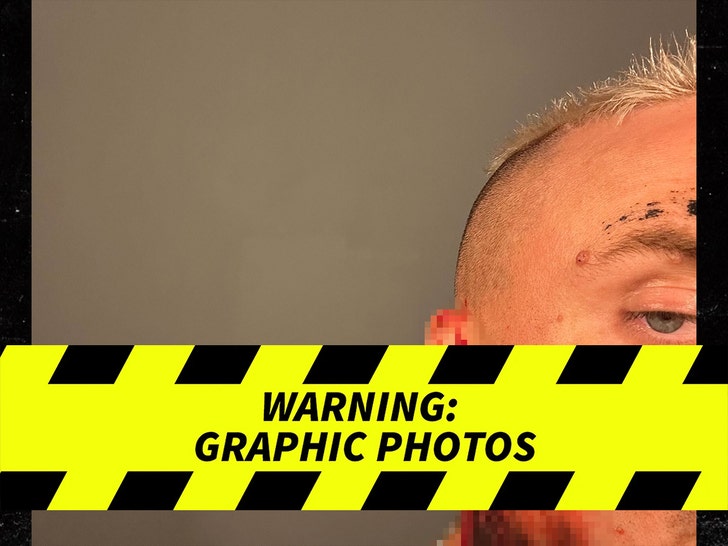 Darby Allinu2019s Gruesome Ear Injury u2014 Graphic Photo