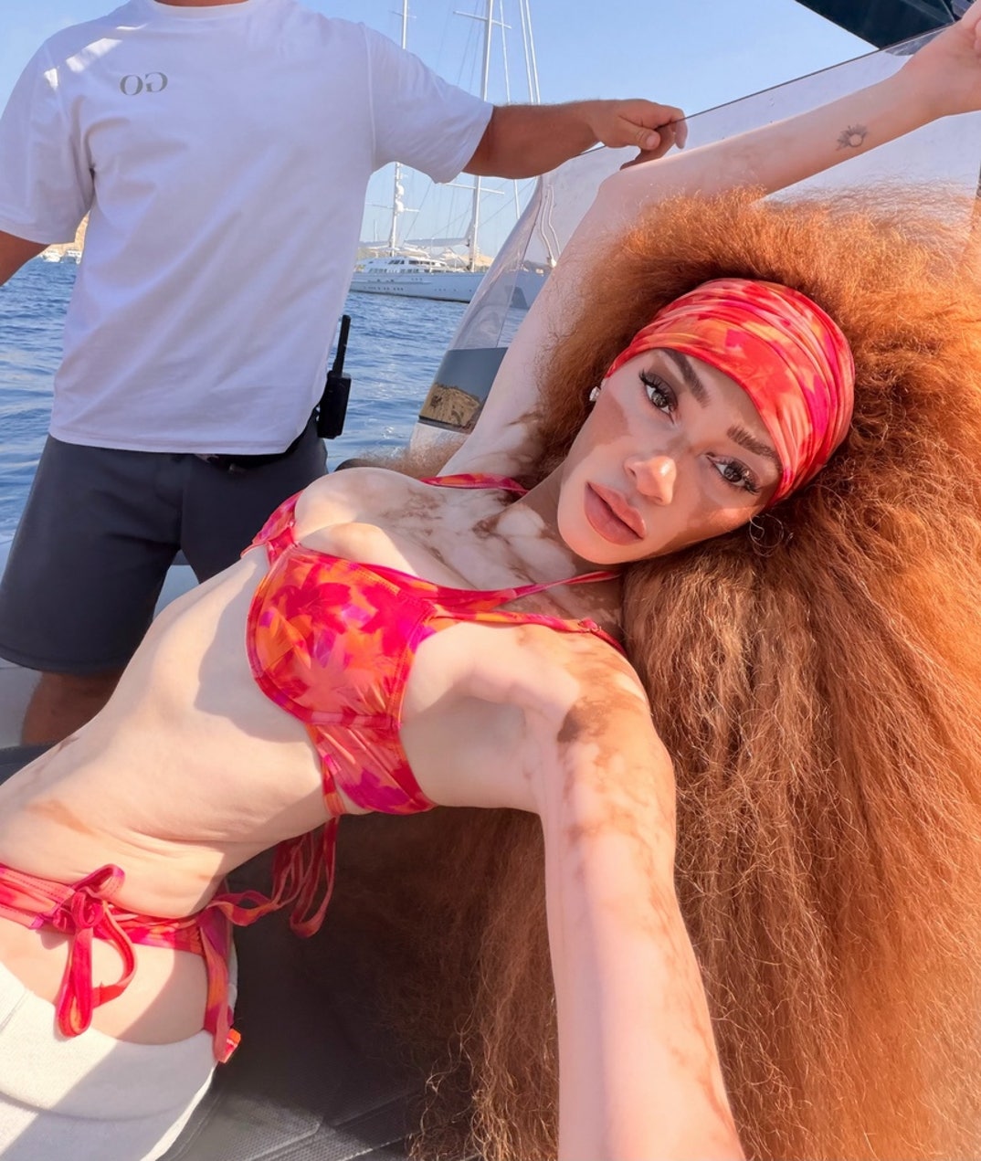 Winnie Harlow