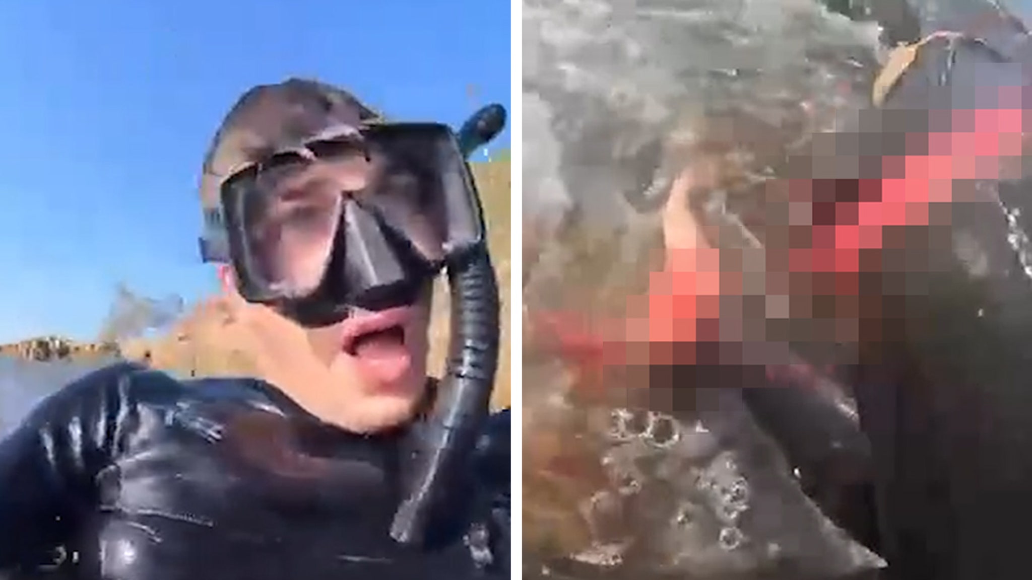 Man Films Aftermath of Shark Attack That Claimed His Leg in Australia