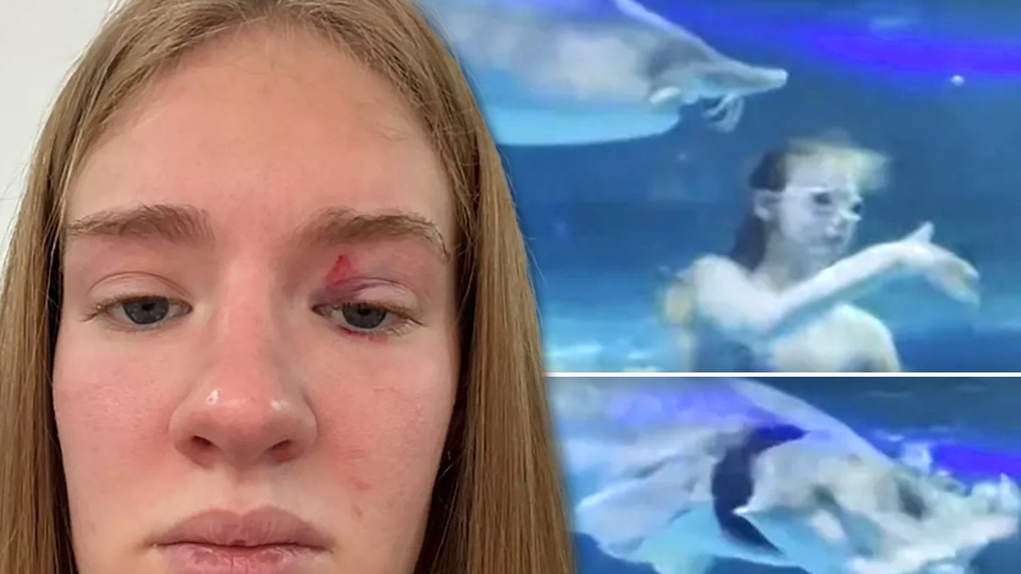 Mermaid Performer Says She Was Rushed to Hospital After Viral Fish Attack