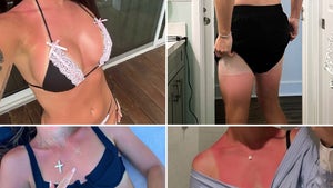 0825-Celebrity-Sunburns-Guess-Who-PRIMARY