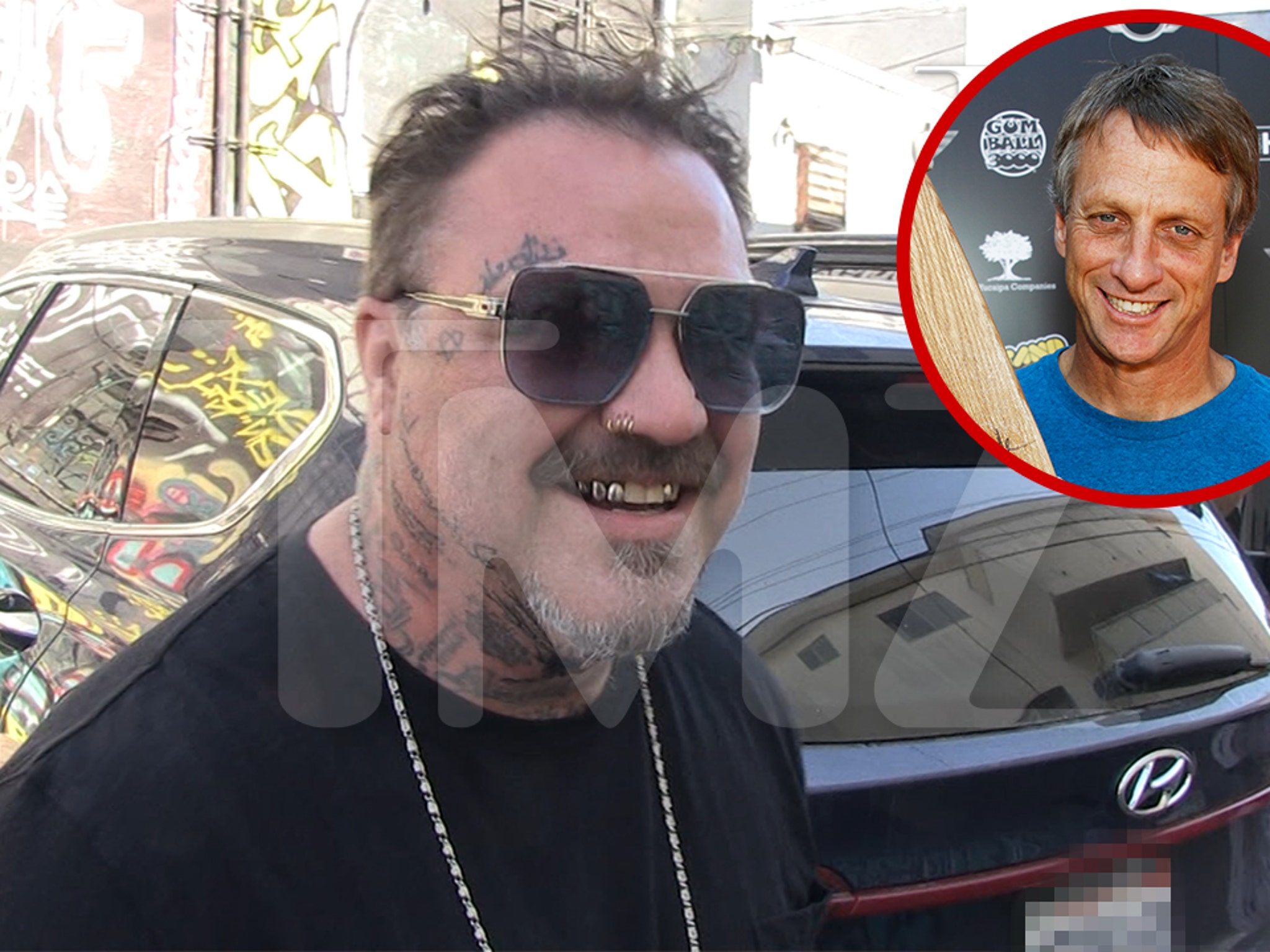 Bam Margeras Doc Told Him Legs Were Rotted Rubber Bands Because of Booze