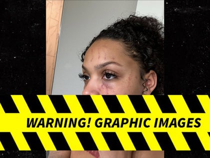 0107-0107-Dacoda-Nichole-Abuse-PRIMARY