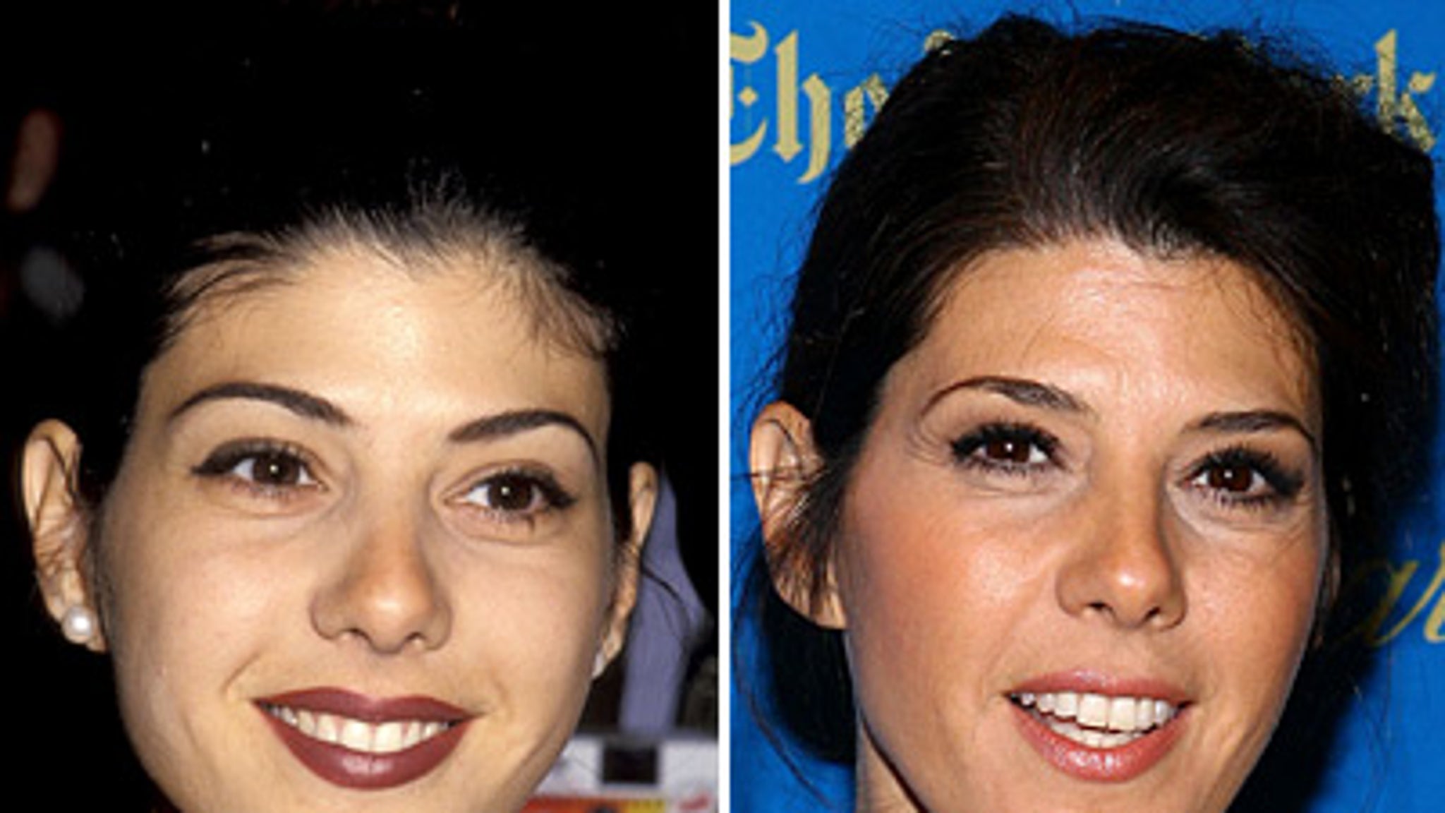 Marisa tomei plastic surgery